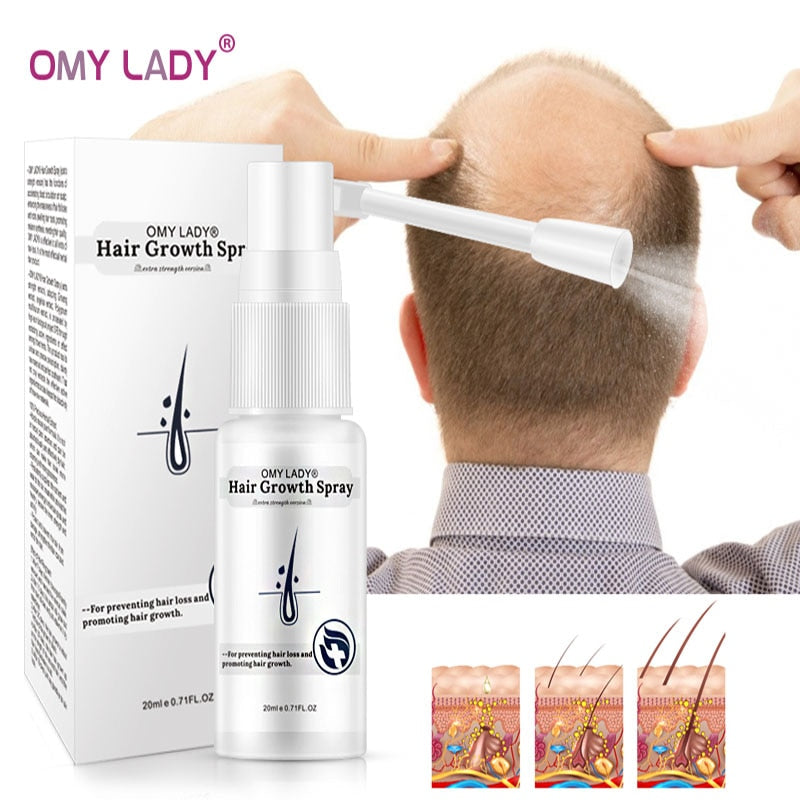 OMY LADY Anti Hair Loss Hair Growth Spray Essential Oil Liquid For Men Women Dry Hair Regeneration Repair Hair Loss Products