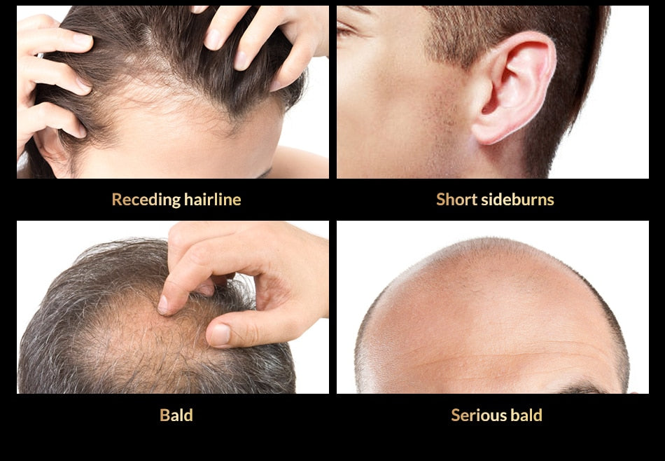 OMY LADY Anti Hair Loss Hair Growth Spray Essential Oil Liquid For Men Women Dry Hair Regeneration Repair Hair Loss Products