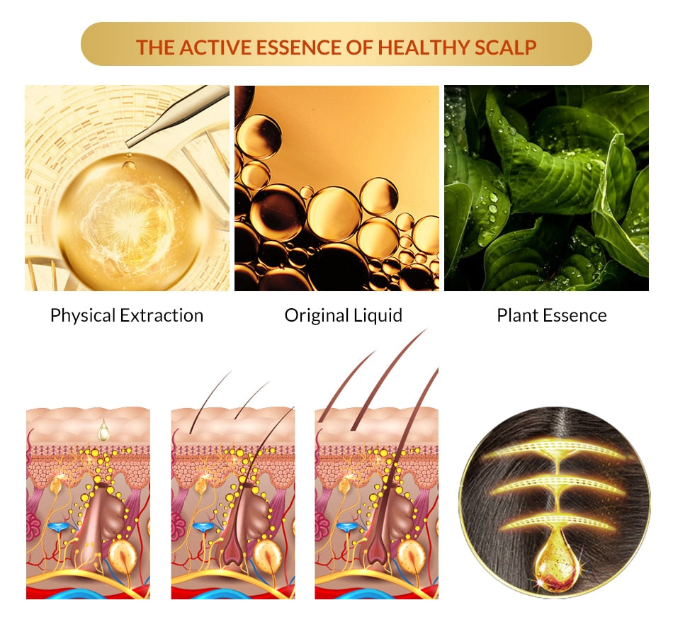 OMY LADY Anti Hair Loss Hair Growth Spray Essential Oil Liquid For Men Women Dry Hair Regeneration Repair Hair Loss Products