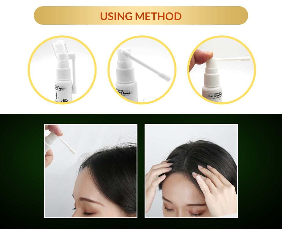 OMY LADY Anti Hair Loss Hair Growth Spray Essential Oil Liquid For Men Women Dry Hair Regeneration Repair Hair Loss Products